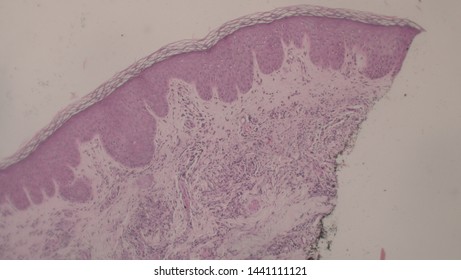 Microscopy Of Cytopathology Slides And Histopathology. Slides Of Cytopathology.