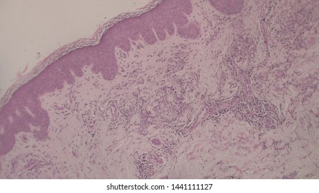 Microscopy Of Cytopathology Slides And Histopathology. Slides Of Cytopathology.