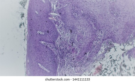 Microscopy Of Cytopathology Slides And Histopathology. Slides Of Cytopathology.