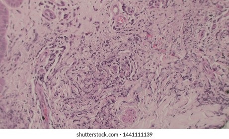 Microscopy Of Cytopathology Slides And Histopathology. Slides Of Cytopathology.