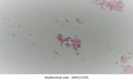 Microscopy Of Cytopathology Slides And Histopathology. Slides Of Cytopathology.