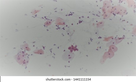 Microscopy Of Cytopathology Slides And Histopathology. Slides Of Cytopathology.