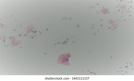 Microscopy Of Cytopathology Slides And Histopathology. Slides Of Cytopathology.