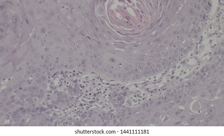 Microscopy Of Cytopathology Slides And Histopathology. Slides Of Cytopathology.