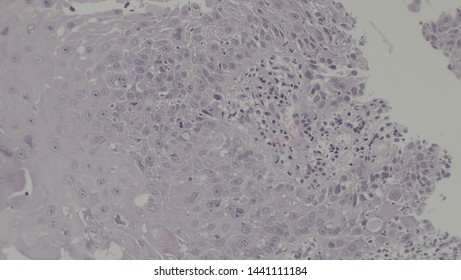 Microscopy Of Cytopathology Slides And Histopathology. Slides Of Cytopathology.