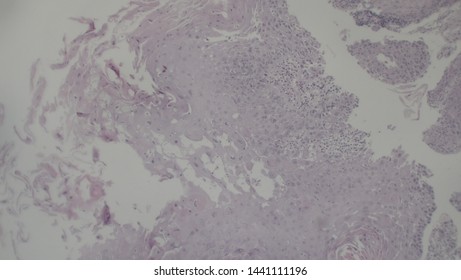 Microscopy Of Cytopathology Slides And Histopathology. Slides Of Cytopathology.