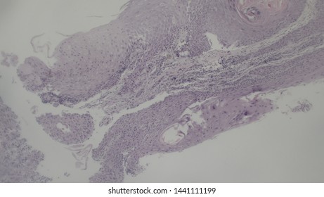 Microscopy Of Cytopathology Slides And Histopathology. Slides Of Cytopathology.