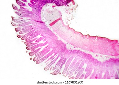 133 Mucous membrane intestine Images, Stock Photos & Vectors | Shutterstock