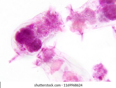 Microscopy Photography. Water Zooplancton Rotifera