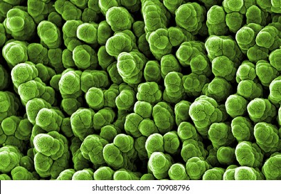 micro-structures on aluminum surface