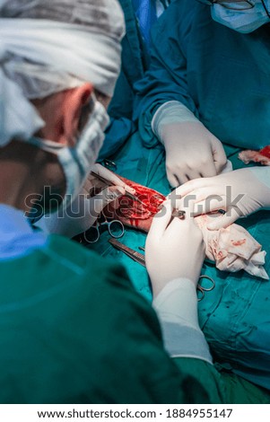 Microvascular forearm surgery in hospital
