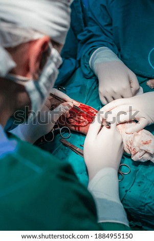 Microvascular forearm surgery in hospital