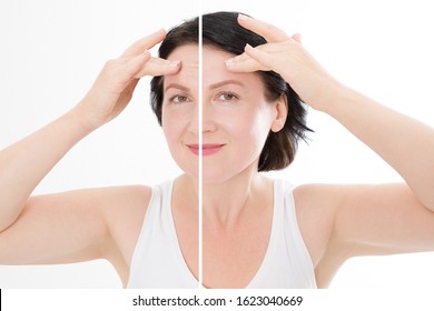 Middle Age Close Up Forehead Woman Happy Face Before After Cosmetic Procedures. Skin Care For Wrinkled Face. Before-after Anti-aging Facelift Treatment. Facial Skincare, Contouring. Beauty And Make-up