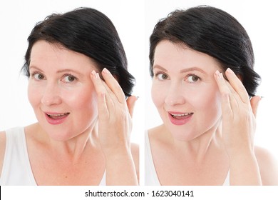 Middle Age Close Up Woman Happy Face Before After Cosmetic Procedures. Skin Care For Wrinkled Face. Before-after Anti-aging Facelift Treatment. Facial Skincare And Contouring. Beauty And Make-up