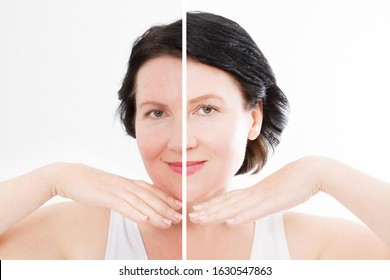 Middle Age Close Up Woman Happy Face Before After Cosmetic Procedures. Skin Care For Wrinkled Face. Before-after Anti-aging Facelift Treatment. Facial Skincare And Contouring. Beauty And Make-up