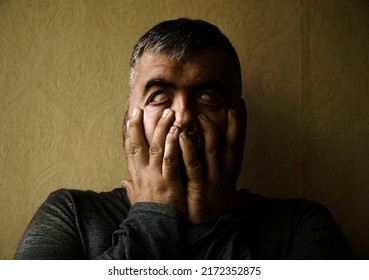 Middle Age Man Pulls Eyelids Eyes Stock Photo 2172352875 | Shutterstock