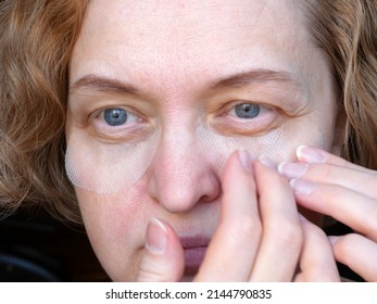 middle aged female's eye with drooping eyelid with patch for eyes. Ptosis is a drooping of the upper eyelid, lazy eye. Cosmetology and facial concept, first wrinkles, closeup