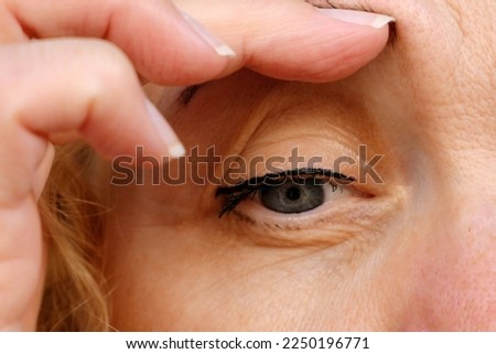 middle aged female's eye with drooping eyelid . Ptosis is a drooping of the upper eyelid, lazy eye. Cosmetology and facial concept, first wrinkles, closeup
