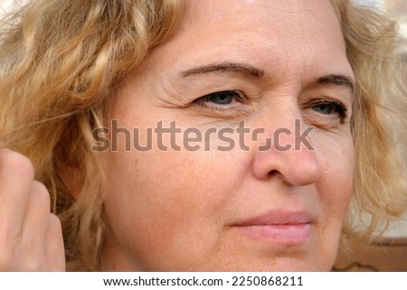 middle aged female's eye with drooping eyelid with patch for eyes. Ptosis is a drooping of the upper eyelid, lazy eye. Cosmetology and facial concept, first wrinkles, closeup