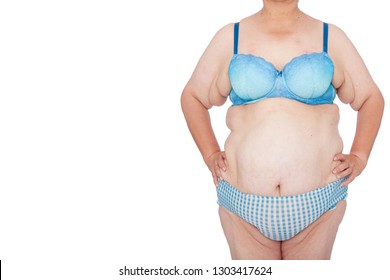 Middle aged woman with excess skin after babies and extreme weight loss. Before brachioplasty, panniculectomy, abdominoplasty and mummy makeover. Full body front view hands on hips, copy space left.