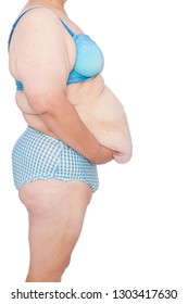 Middle aged woman with excess skin after babies and extreme weight loss. Before brachioplasty, panniculectomy, abdominoplasty and mummy makeover. Side view, facing right holding excess belly skin.