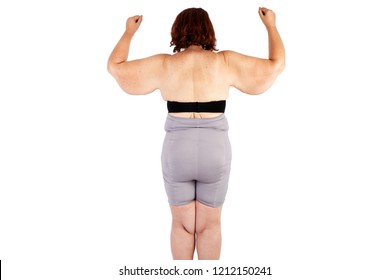 Middle aged woman with sagging excess arm skin extreme weight loss. Inspiration for poster and meme, before brachioplasty, panniculectomy, abdominoplasty and mummy makeover in Australia.