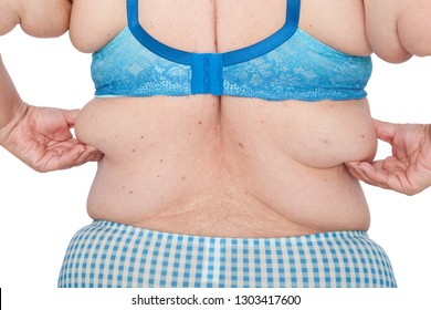 Middle aged woman with sagging excess arm skin after extreme weight loss. Before brachioplasty, panniculectomy, abdominoplasty and mummy makeover. Back view holding exces skin.