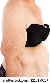 Middle aged woman with sagging skin after babies and extreme weight loss. Inspiration for poster and meme, before brachioplasty, panniculectomy, abdominoplasty and mummy makeover in Australia.