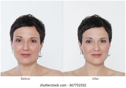 Middle aged Woman with and without bags under the eyes, aging singes, wrinkles, blemishes. Before and after cosmetic or plastic procedure, anti-age therapy, blepharoplasty.