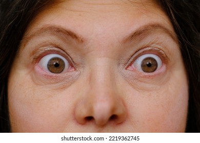 middle-aged mature woman with bulging eyes, upper face close-up, goggle eyes in fright, staring at camera, Very strong surprise or fright, horror in look, concept of cosmetic anti-aging procedures - Shutterstock ID 2219362745