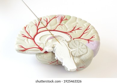 Miicroelectrode recording on the brain model. Concept of brain recording in subthalamic nucleus for Parkinson disease surgery.