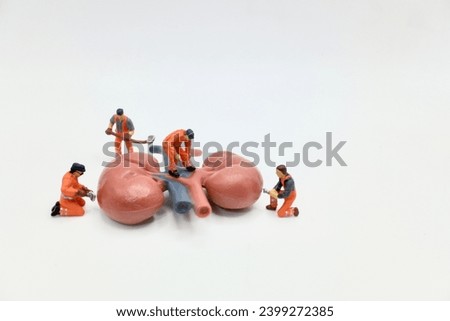 miniature figurines of men at work on a pair of human kidneys