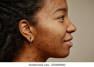 Minimal profile portrait of ethnic young woman smiling with acne scars on face and ear piercings