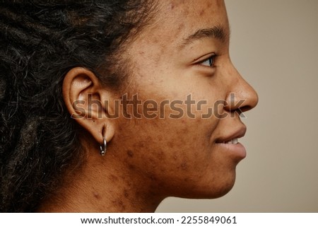 Minimal profile portrait of ethnic young woman smiling with acne scars on face and ear piercings Imagine de stoc © 