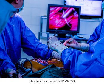 Minimally Invasive Surgery In Heart Surgery
Patient Will Fast Recovery Back To Normal Life Style 