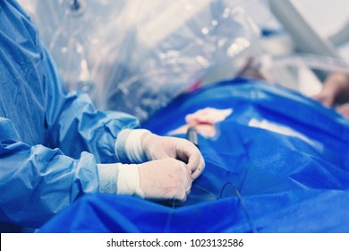 Minimally invasive transcatheter closure treatment for left atrial appendage LLA with occluder, using a minimally invasive procedure treatment of structural heart disease - Shutterstock ID 1023132586