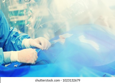 Minimally invasive transcatheter closure treatment for left atrial appendage LLA with occluder, using a minimally invasive procedure treatment of structural heart disease - Shutterstock ID 1023132679