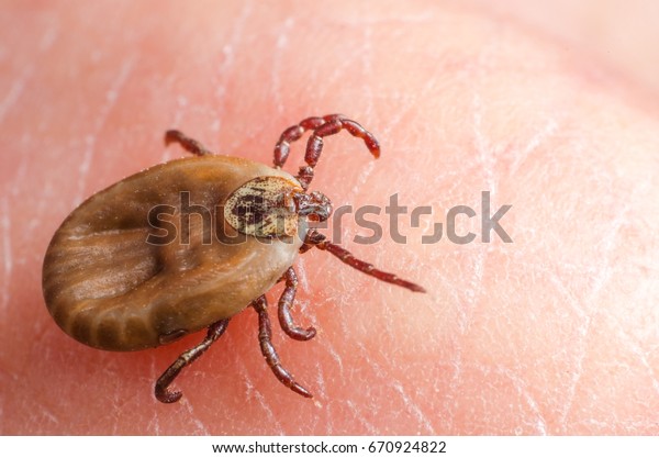 Mite crawls on human
skin.