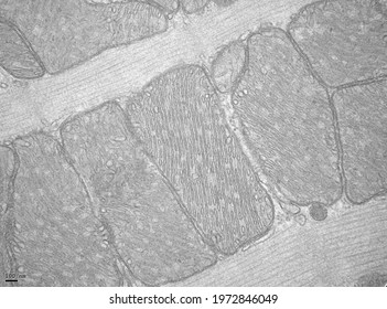 Mitochodia under the electron microscope