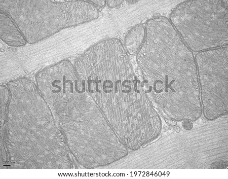 Mitochodia under the electron microscope