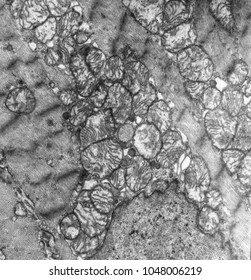 Mitochondria Organelle In Cardiac Muscle Cell Tissue Electron Microscope 