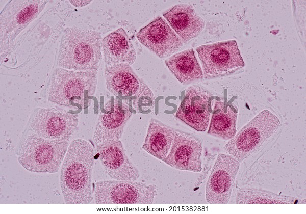 Mitosis cell in the Root tip of Onion under
a microscope.
