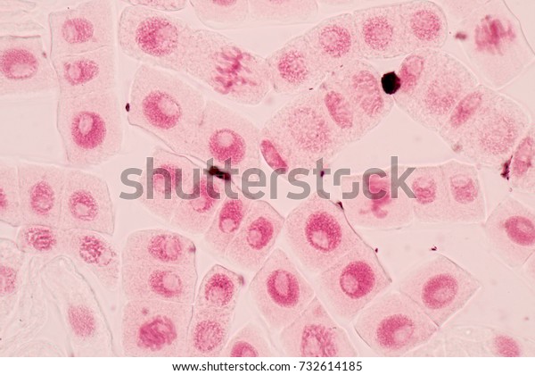 Mitosis\
cell in Root tip of Onion under a\
microscope.\
