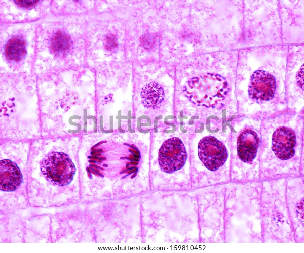 Mitosis in onion cells of the root meristem.\
In the central rowof cells, there is a prophase cell showing\
chromosomes. Below, a typical anaphase can be seen. Light\
microscope micrograph.