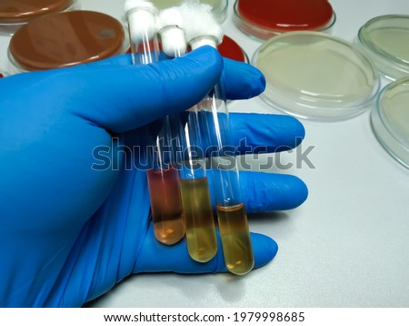  MIU Medium Base (Motility Indole Urea Medium) is a semisolid medium designed for detection in Enterobacteriaceae of urease activity, motility at microbiology laboratory.
