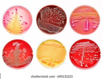 Mixed Of Bacteria Colonies In Various Petri Dish
