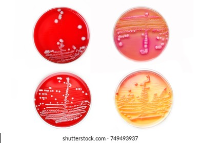 Mixed of bacteria colonies in various petri dish
