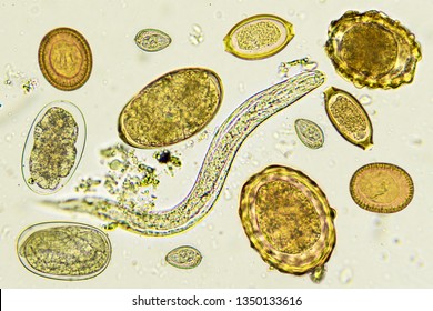 Mixed Of Helminthes Or Parasitic Worm In Stool, Analyze By Microscope