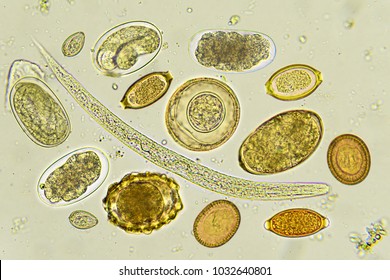 Mixed Helminthes Stool Analyze By Microscope Stock Photo 1032640801 ...