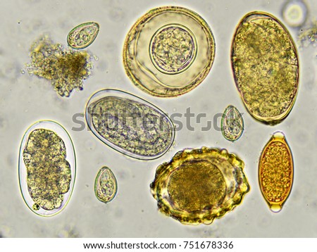 Mixed of helminthes in stool, analyze by microscope